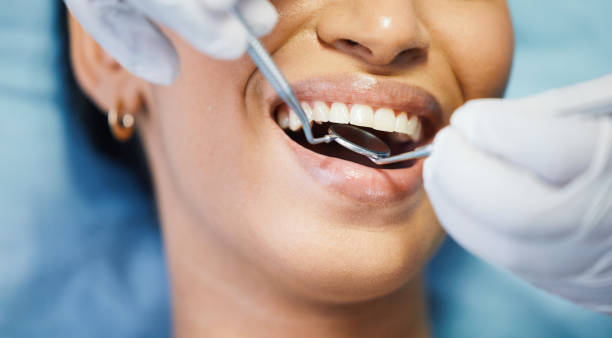 Best Dentist for Tooth Abscess  in Beloit, OH